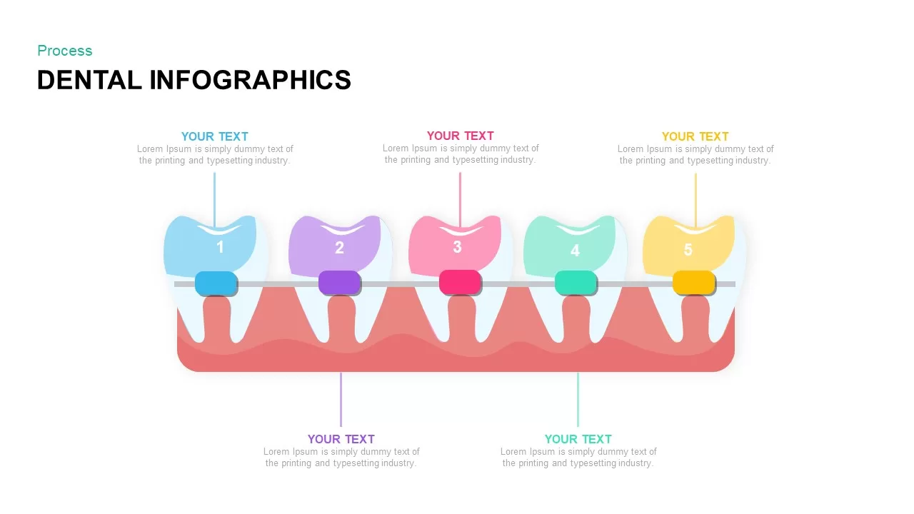 dental infographics