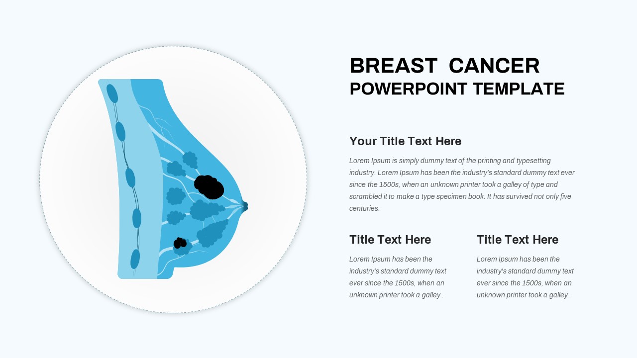 Breast Cancer PowerPoint Template