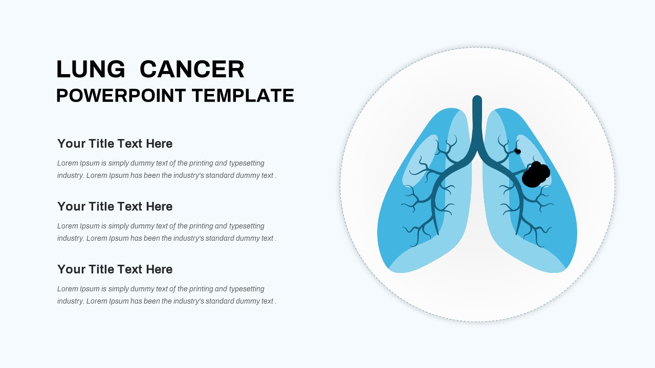 Lung Cancer PowerPoint Template